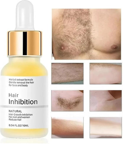15276